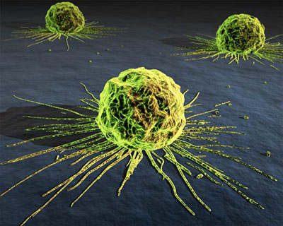 20111129145750-cancer-cells.jpg