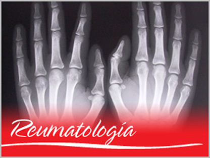 20130706131324-12-medicina-reumatologia-do.jpg